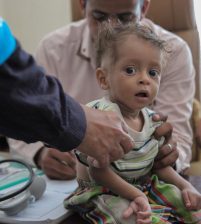 الامم المتحدة: 19 مليون يمني يعانون من المجاعة