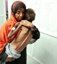 الكوليرا تشارك تحالف السعودية بقتل أطفال اليمن