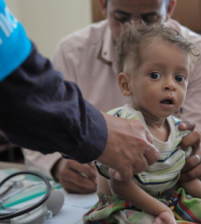 الأمم المتحدة : السعودية تمنع وصول مساعدات الى اليمن